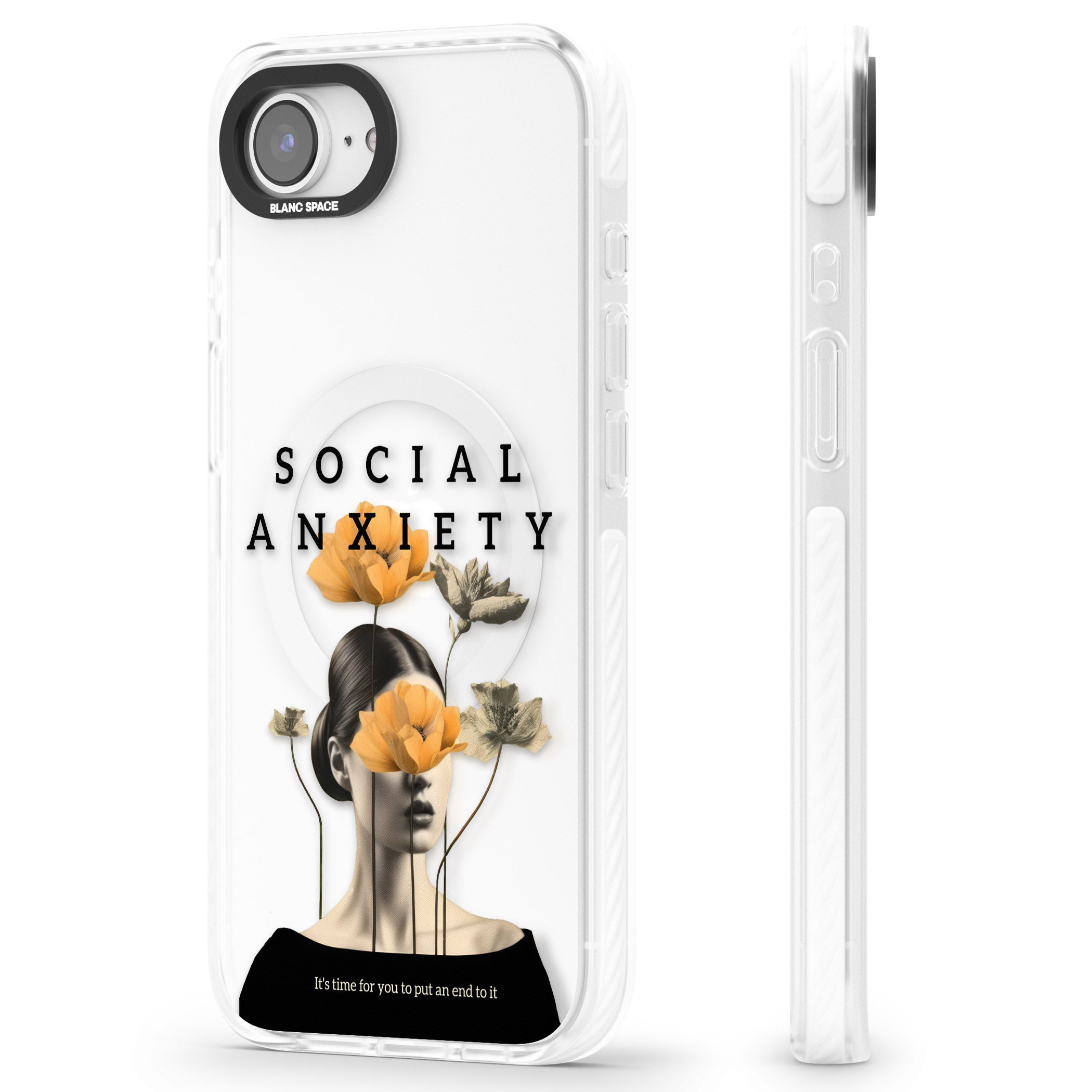 Social Anxiety